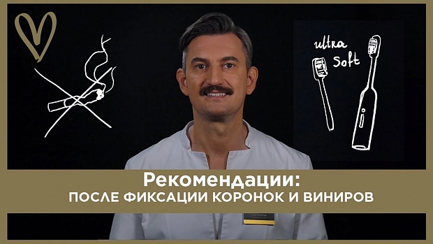 После фиксации коронок и виниров